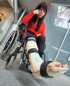 Mujer en una silla de ruedas con una pierna mala. 
